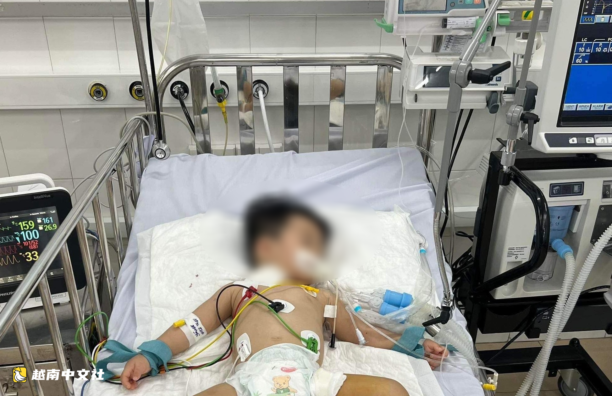 越南VNVC啟動首針手足口病疫苗接種
